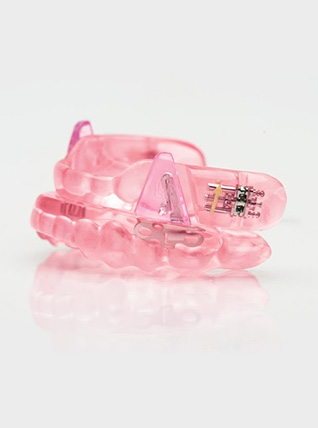 somnodent sleep apnea appliance